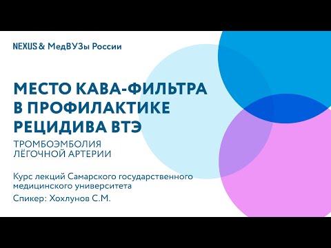 Видео: Место кава-фильтра в профилактике рецидива ВТЭ