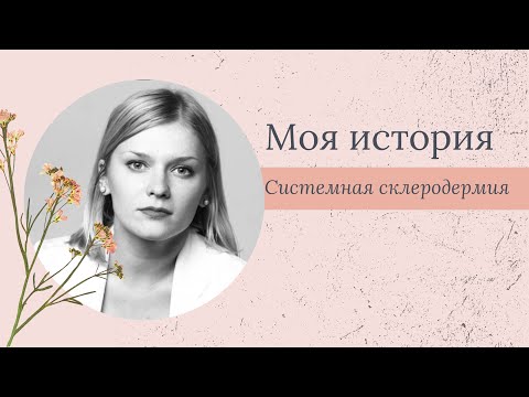 Видео: Моя история: Анастасия Лазарева о жизни с системной склеродермией