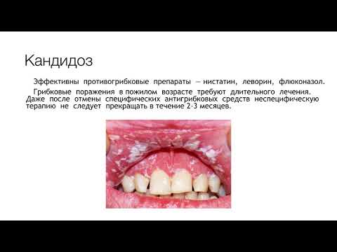 Видео: Патология СОР у пожилых. Практическое занятие