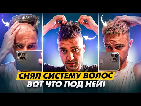 Видео: Насколько сложно использовать систему волос? Мой опыт 7 лет / KRASAV4IK