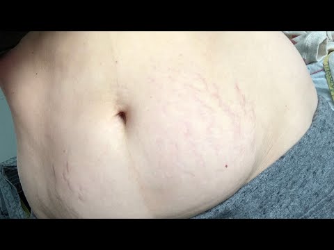 Видео: Живот после родов. 3 неделя после родов. Первый месяц новорожденного.