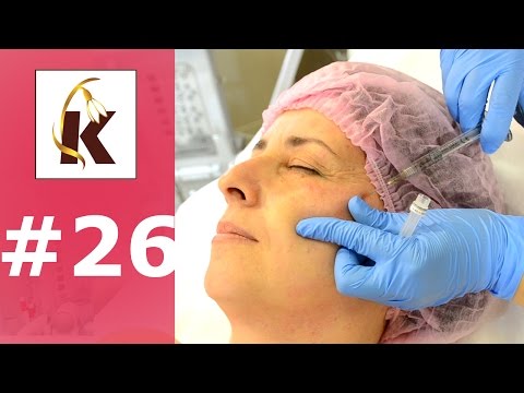 Видео: Треугольник молодости, как омолодить лицо, убрать брыли, подтянуть подбородок, лифтинг скул.