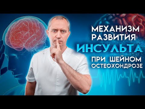 Видео: Механизм развития инсульта при шейном остеохондрозе