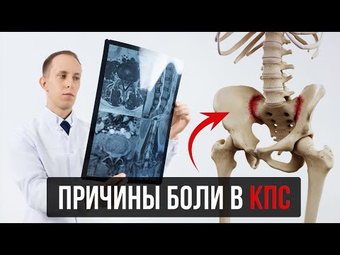 Видео: Боль из крестцово-подвздошного сустава (КПС): лучшие практики диагностики и лечения