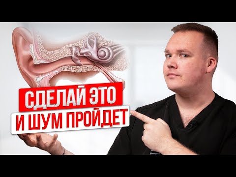 Видео: Убери ШУМ В УШАХ за 5 минут! Сделай это сейчас,УПРАЖНЕНИЯ от шума в ушах и звона
