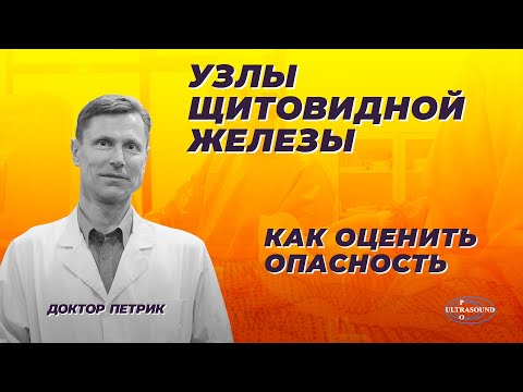 Видео: Узлы щитовидной железы.Как оценить опасность и что делать.
