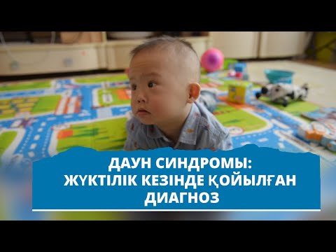 Видео: Даун Синдромы: жүктілік кезінде қойылған диагноз