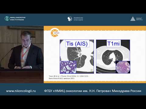 Видео: Стадирование рака легкого