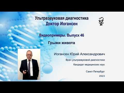 Видео: Ультразвуковая диагностика (УЗИ). Доктор Иогансен. Видеопримеры. Выпуск 46. Грыжи живота.