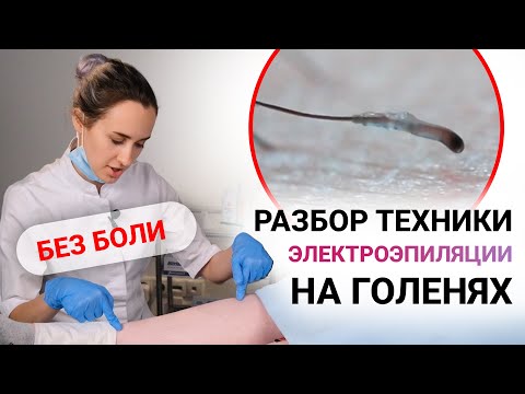 Видео: Урок №40. Техника проведения электроэпиляции: как делать электроэпиляцию без боли
