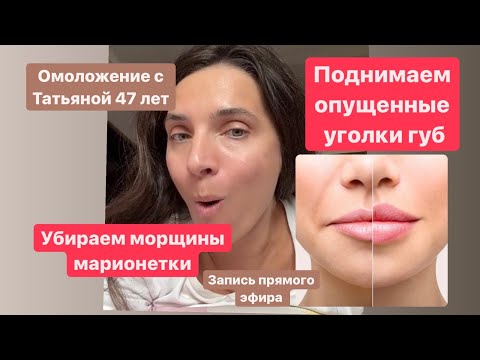 Видео: Убираем морщины марионетки