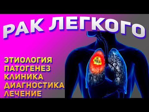 Видео: Рак легкого. Признаки, диагностика и методы лечения рака легких.