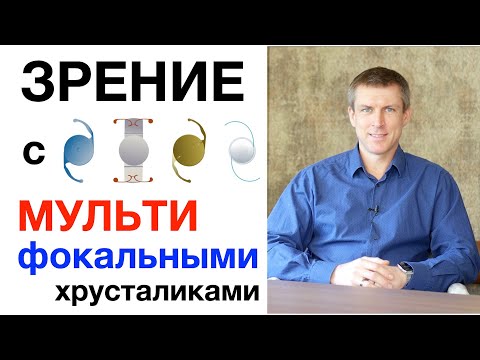 Видео: Зрение с мультифокальным хрусталиком - самый важный параметр выбора ИОЛ