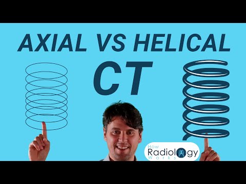 Видео: Сравнение режимов КТ-сканирования (аксиальный и спиральный)