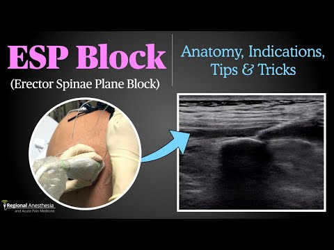 Видео: Блок Erector Spinae Plane (ESP)