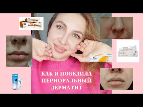 Видео: ПЕРИОРАЛЬНЫЙ ДЕРМАТИТ| ЛЕЧЕНИЕ, КОТОРОЕ ПОМОГЛО