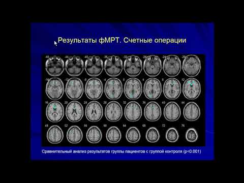 Видео: Симещенко П.И. «Лучевая диагностика супратенториальных опухолей головного мозга»