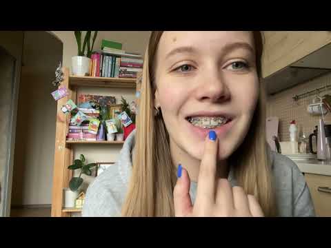 Видео: 3 МЕСЯЦА С МИНИВИНТОМ #мояисториябрекетов #самолигирующиебрекеты #минивинт