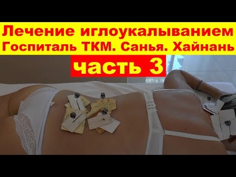 Видео: Медицинский массаж, лечение иглоукалыванием. Госпиталь ТКМ. Санья. Хайнань. Китай 🏥