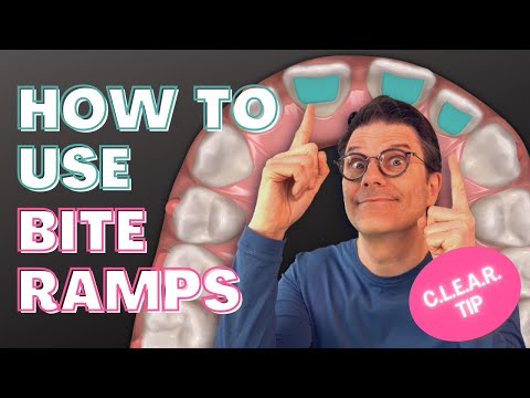 Видео: Как и когда использовать прозрачные элайнеры Invisalign?