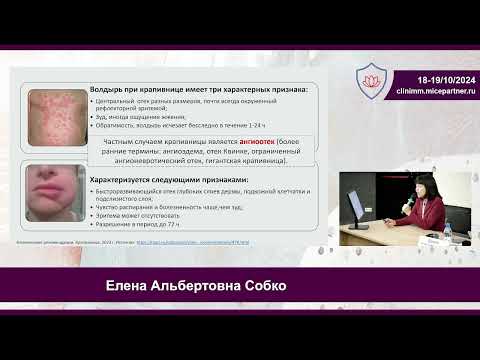 Видео: Е.А. Собко Возможности терапии тяжелого течения хронической спонтанной крапивницы