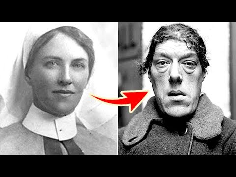 Видео: Из красавицы в чудовище. От историй этих женщин вы будете в шоке!