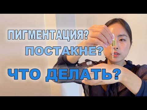 Видео: 7 СРЕДСТВ ОТ ПИГМЕНТАЦИИ И ПОСТАКНЕ / ISNTREE, MISSHA, COSRX, FAU ...