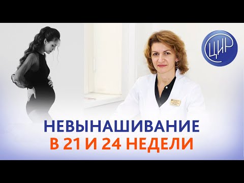 Видео: Невынашивание беременности в 24 и 21 неделю. В чём причина? Дементьева С.Н.