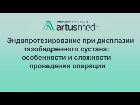 Видео: Дисплазия тазобедренного сустава и сложность проведения эндопротезирования и реабилитации.