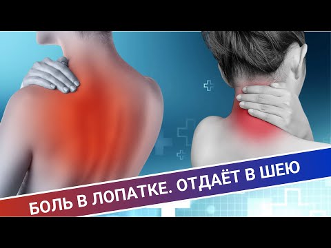 Видео: БОЛЬ В ЛОПАТКЕ ОТДАЁТ В ШЕЮ