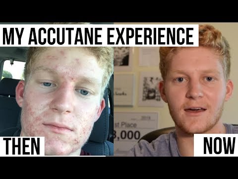 Видео: Мой опыт приема Аккутана в течение 8 месяцев