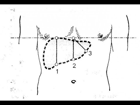 Видео: Размеры печени по Курлову.  Пальпация печени у ребенка