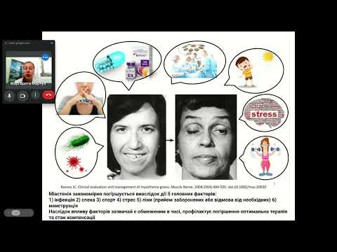 Видео: Міастенія: ВСЕ, що необхідно знати пацієнту! Від лікаря Марчук Маргарити