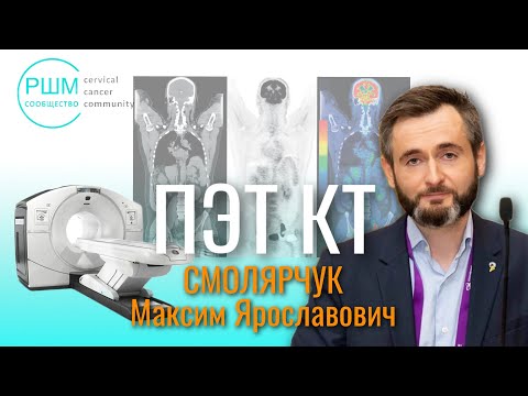 Видео: ПЭТ КТ при диагнозе рак шейки матки.