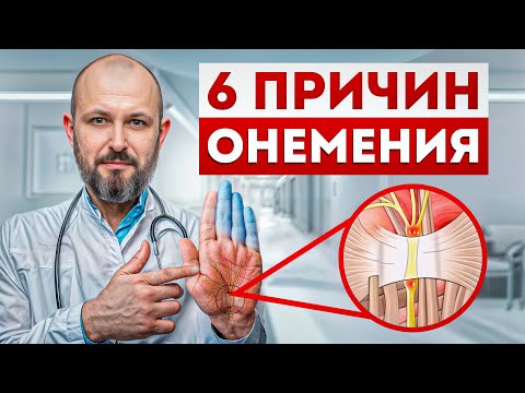 Видео: Онемение – ОПАСНЫЙ сигнал организма! / Почему немеют конечности и как это предотвратить?