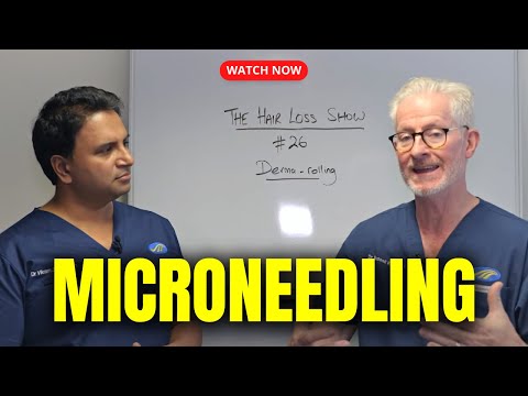 Видео: Дермароллер, микронидлинг и выпадение волос