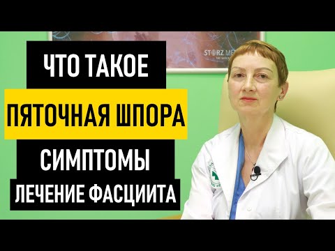 Видео: Пяточная шпора: симптомы и лечение пяточной шпоры. Как вылечить шпору в домашних условиях