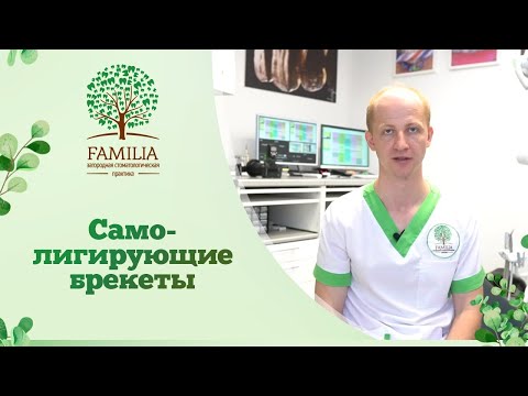 Видео: 👉 Самолигирующие брекеты