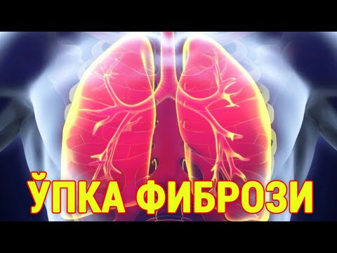 Видео: ЎПКА ФИБРОЗИ