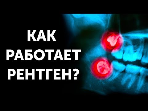 Видео: Как работает рентген?