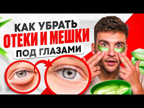Видео: Мешки под глазами УЙДУТ МГНОВЕННО! / Простое упражнение от ОТЁКОВ под ГЛАЗАМИ!