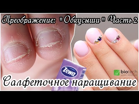 Видео: Преображение: Салфеточное наращивание. "Обкусыши" Часть 2