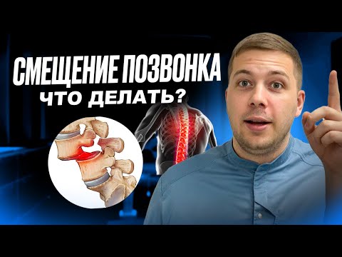 Видео: СПОНДИЛОЛИСТЕЗ. Что такое НАСТОЯЩЕЕ смещение позвонка? Что с этим делать?