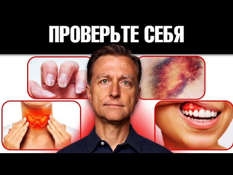 Видео: КАКИХ витаминов вам не хватает? 16 способов узнать ✅