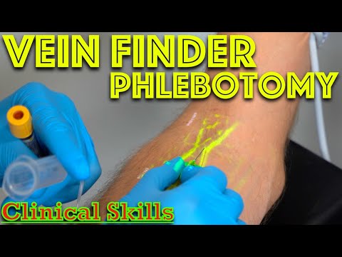 Видео: Поиск вены при флеботомии — подход к забору крови у тревожных пациентов — д-р Гилл