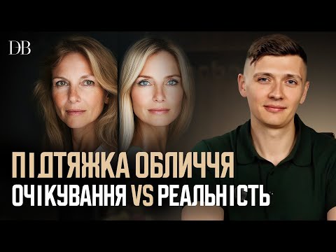 Видео: ПІДТЯЖКА ОБЛИЧЧЯ ВІД А ДО Я: Повна консультація пластичного хірурга Дмитра Березовського