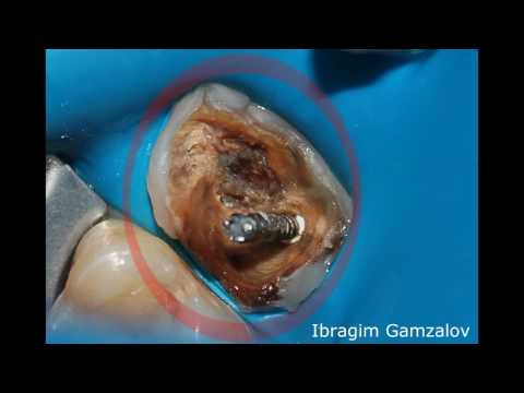 Видео: Необычная изоляция