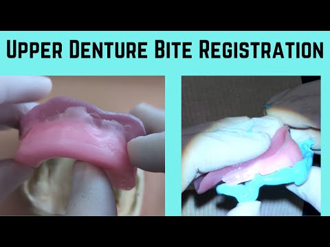 Видео: Регистрация прикуса зубных протезов