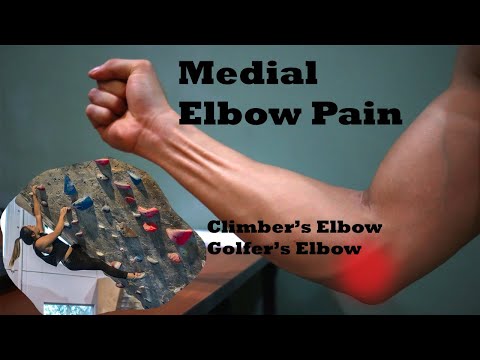 Видео: Локоть скалолаза | Локоть гольфиста | О чём вам не говорят | PhysioEvangelist