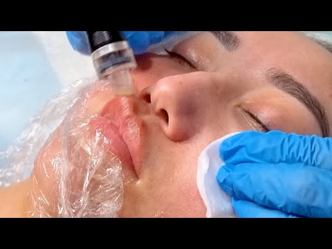 Видео: Как очистить поры и избавиться от черных точек. АКВАЧИСТКА ЛИЦА. Подробное видео от  Елены Румынской
